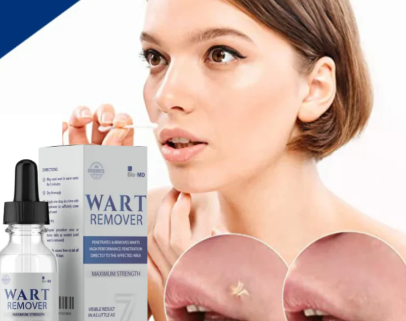 WART REMOVER™ - REMOVEDOR DE VERRUGAS Y LUNARES