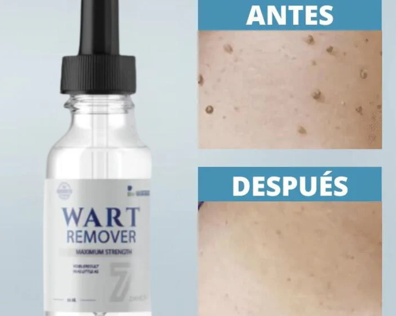 WART REMOVER™ - REMOVEDOR DE VERRUGAS Y LUNARES